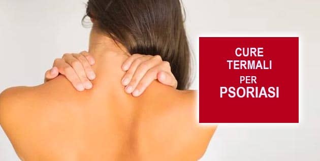 cure termali per psoriasi